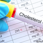 Penting Untuk Mengetahui Tingkat Kolesterol Normal